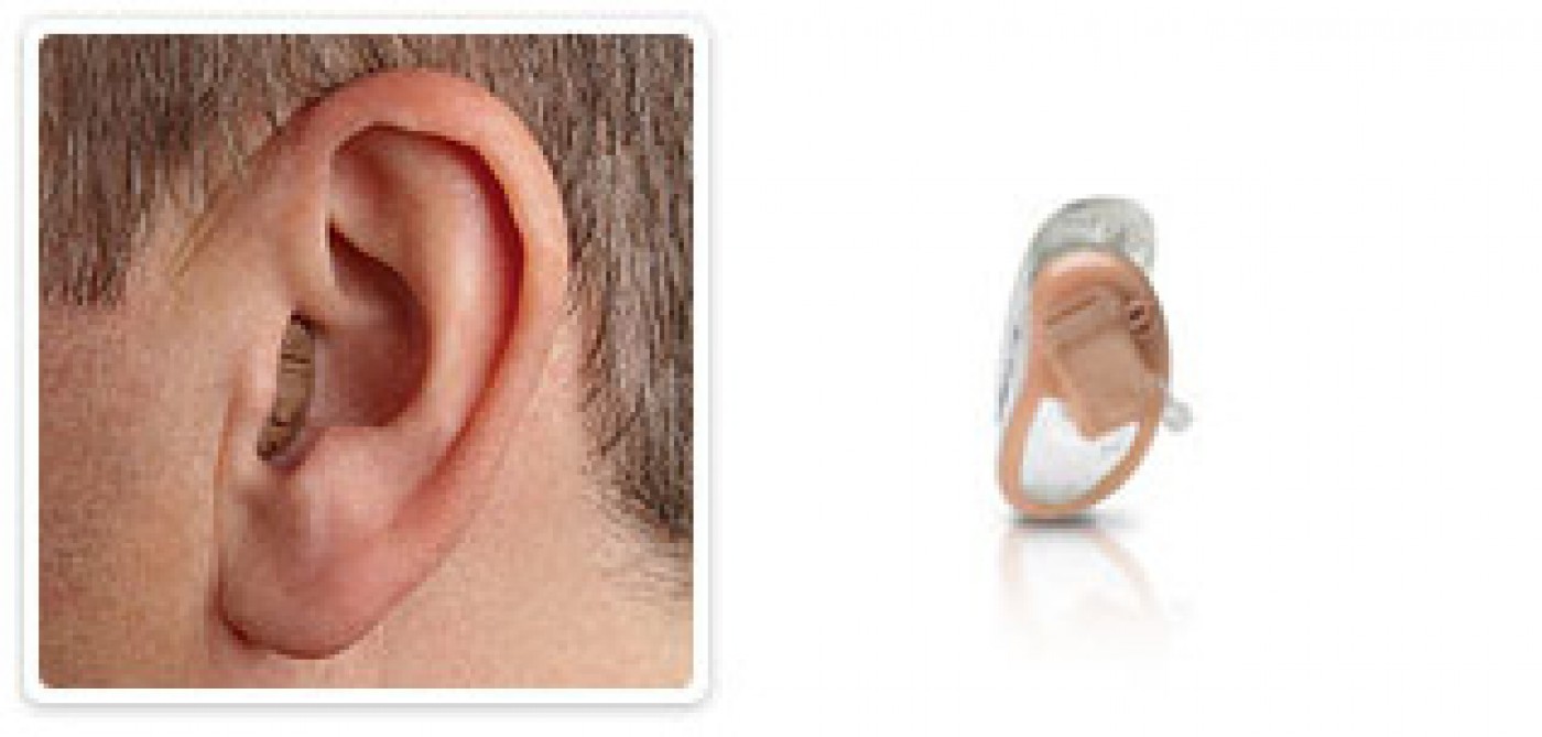 Sontec Hearing Center: hearing aids, free hearing tests and ear care on the Costa del Sol, Andalusia